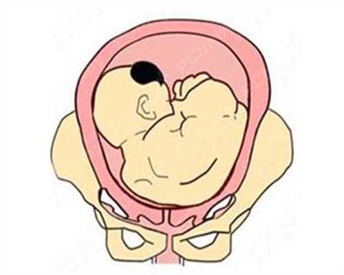上海合法代孕:准备移植，懂得姐妹帮忙看看